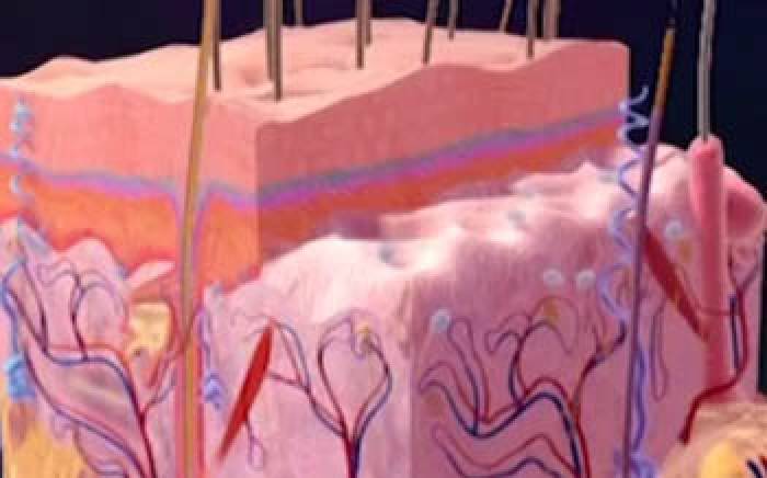 Medical Animation: Acne